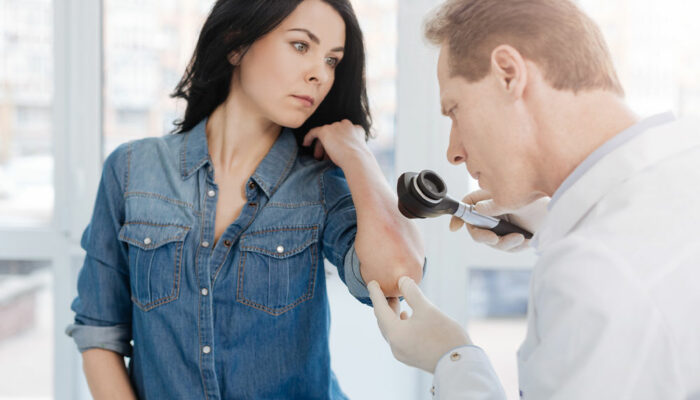 6 Ways to Manage and Prevent Psoriasis