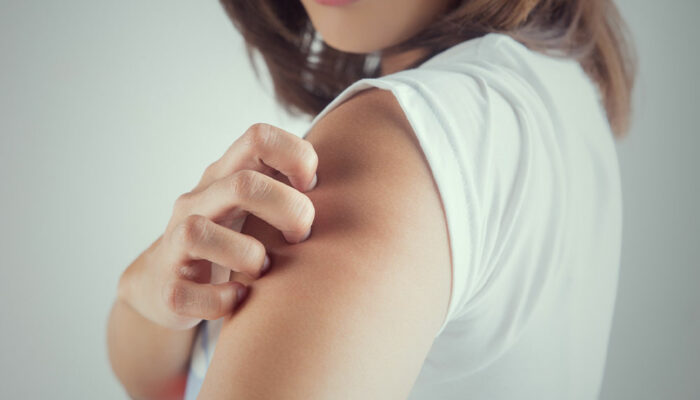 8 common triggers of itchy skin to be aware of