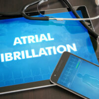Afib – Types, causes, symptoms, and management