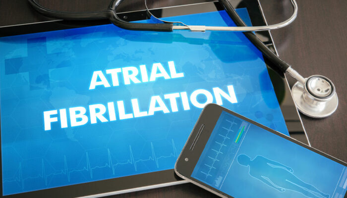 Afib – Types, causes, symptoms, and management