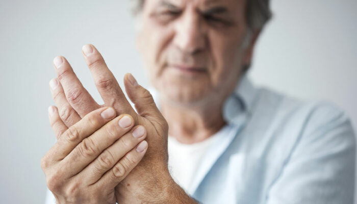 Everything to Know About Rheumatoid Arthritis
